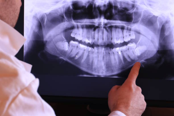 Best Emergency Dental Care for Broken or Chipped Teeth in Atlantic Beach, NY